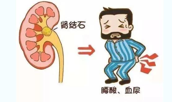 消化系彩超與B超區別？消化系彩超可以檢查什么？
